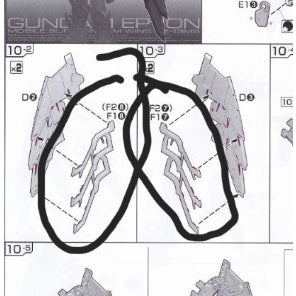 CB RG 15 butcher parts for 1/144 EPYON